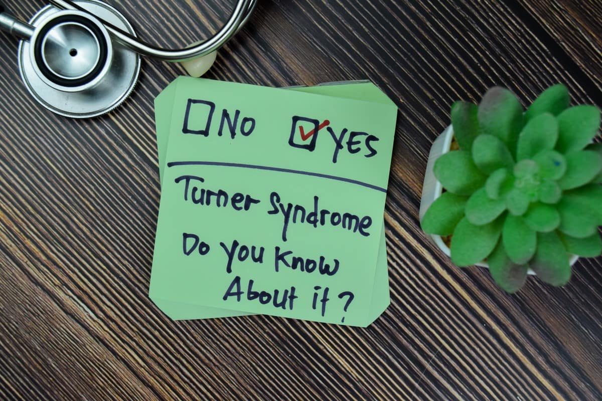 Your 5Minute Guide To Turner Syndrome Health Commune
